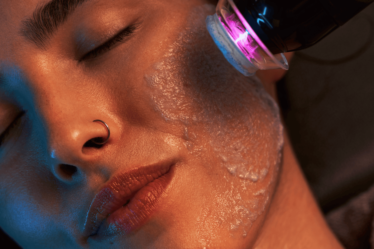 Close up of the Oxy2 facial oxygenation step with active bubbles forming on the skin at FRZN Aesthetics in Frisco, TX