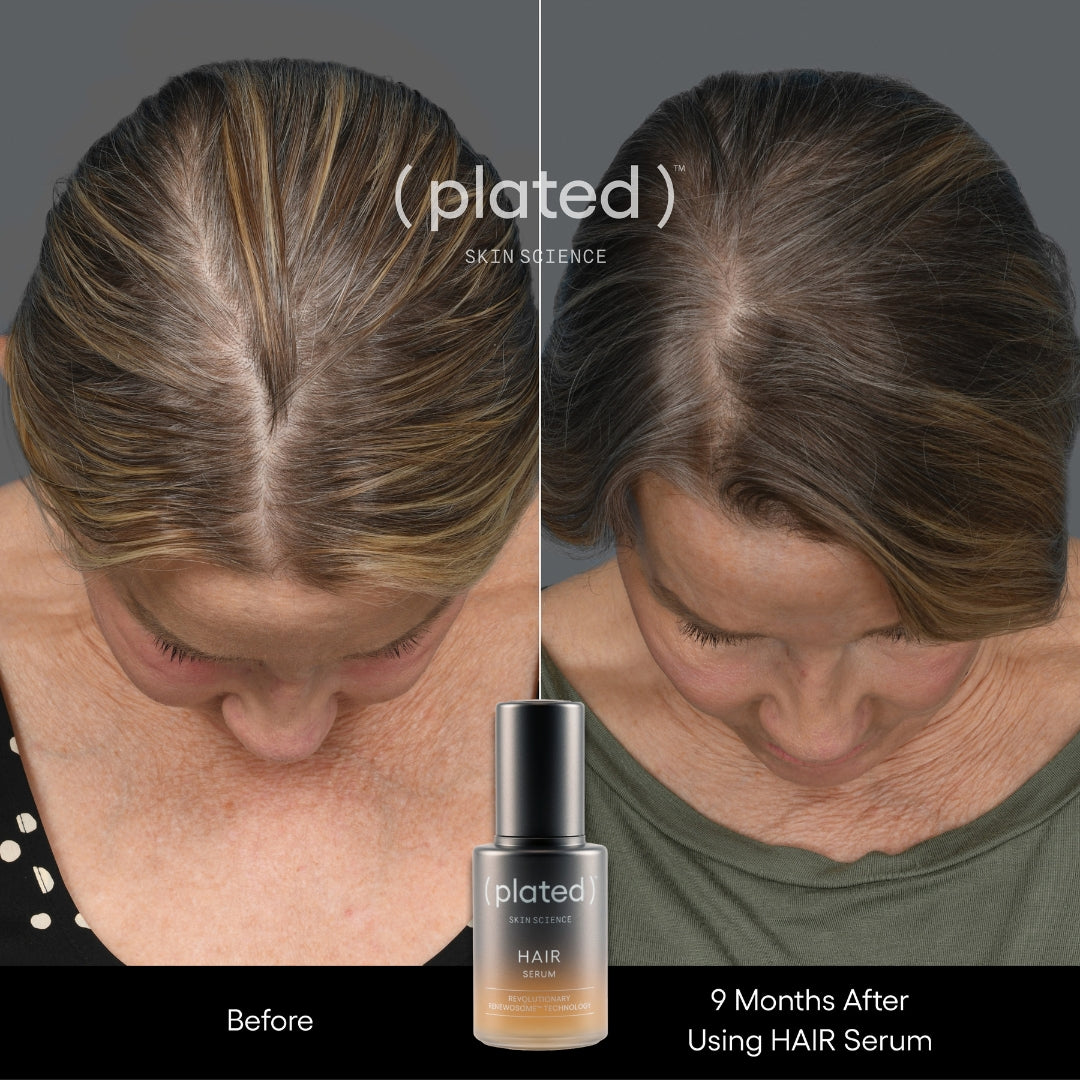 Plated HAIR Serum, before and after results, at FRZN Aesthetics in Frisco, TX