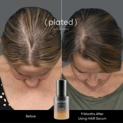 Plated HAIR Serum, before and after results, at FRZN Aesthetics in Frisco, TX