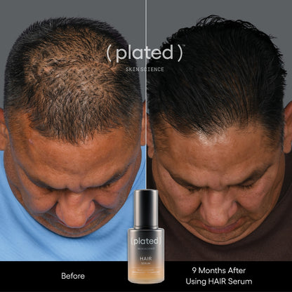 Plated HAIR Serum, before and after results, at FRZN Aesthetics in Frisco, TX