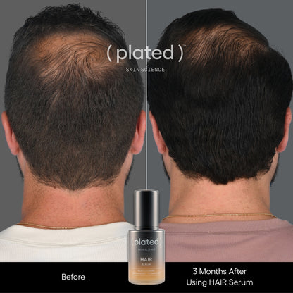 Plated HAIR Serum, before and after results, at FRZN Aesthetics in Frisco, TX