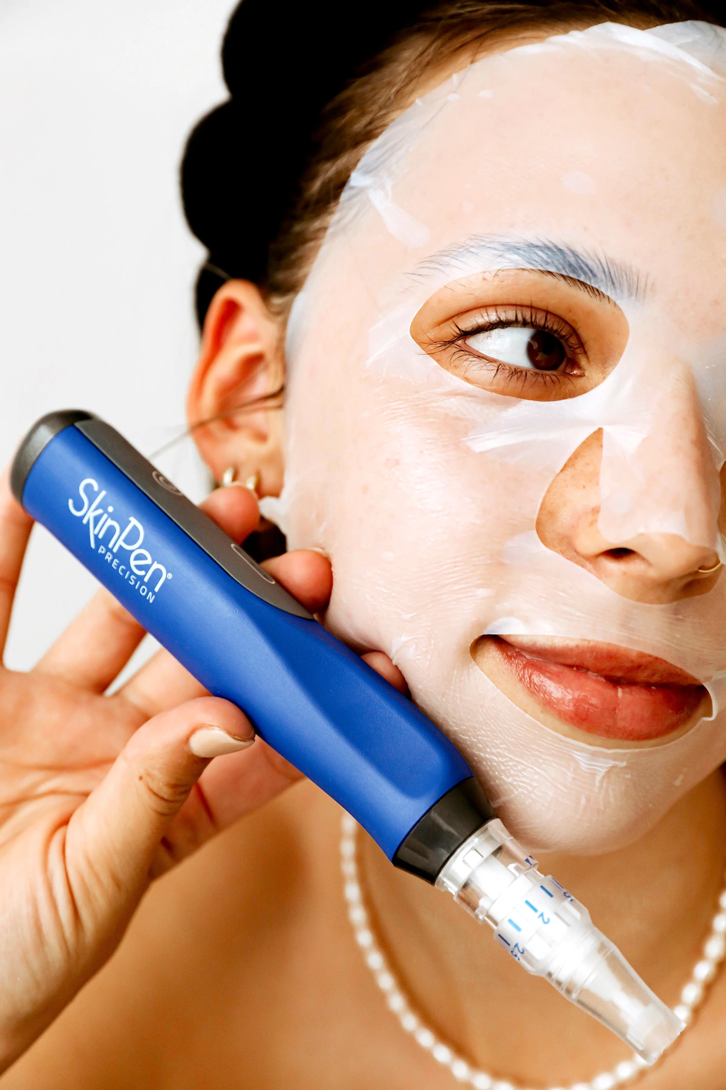 SkinPen microneedling results for skin texture and tone at FRZN Aesthetics in Frisco, Texas