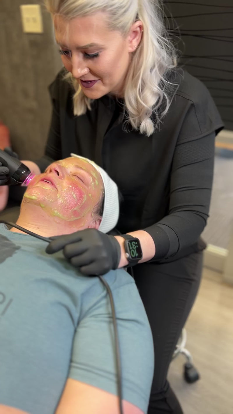 Oxy2 Facial at FRZN Aesthetics in Frisco Texas